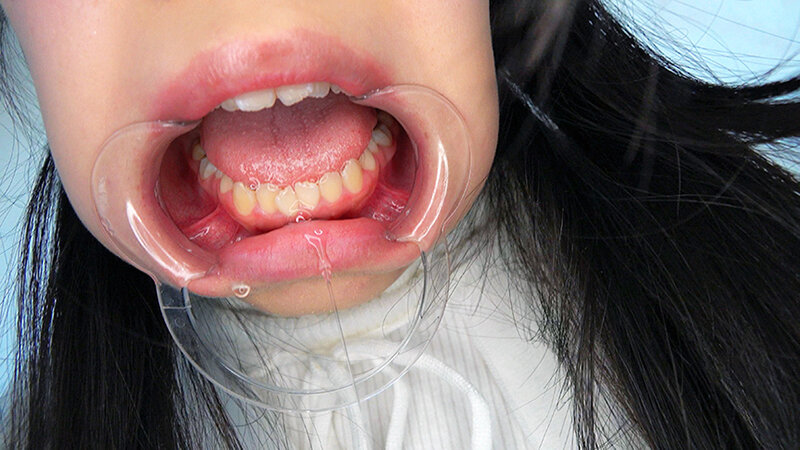 お嬢様は肉便器 生田りん ＃アナル ＃ゲロ ＃開口器 ＃ハードイラマチオ - サンプル画像 - 12