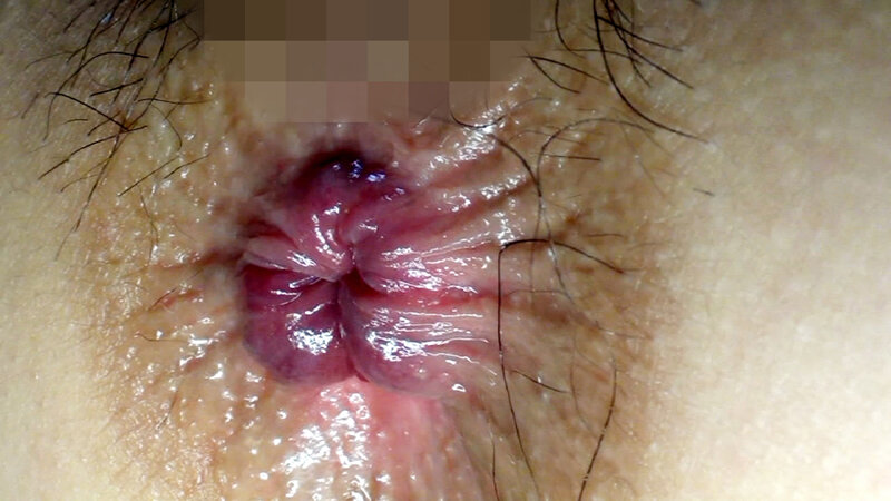 美女のひくつく肛門 放屁 - サンプル画像 - 6