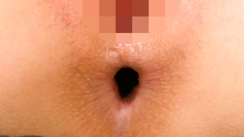 画面にかぶりついて思う存分見て下さい！今夜は激シコ間違い無し！アップで見せつけアナル挑発女子 - サンプル画像 - 4